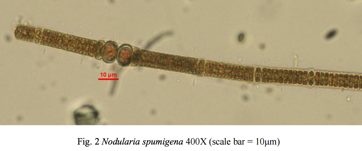 Nodularia